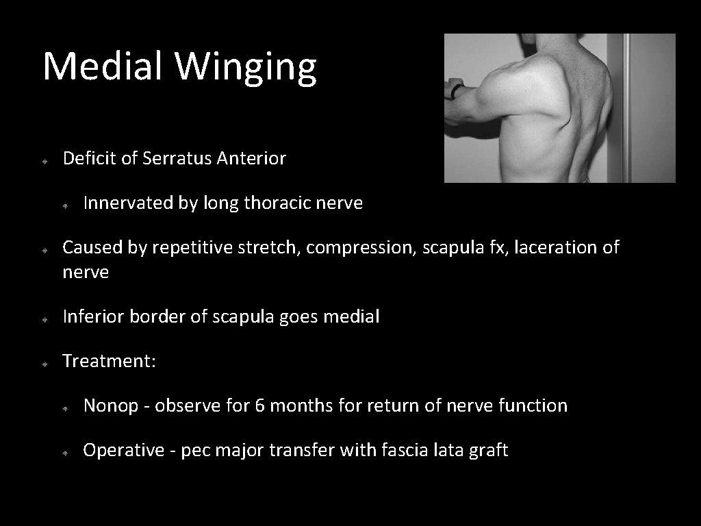 Medial Winging Deficit of Serratus Anterior Innervated by long thoracic nerve Caused by repetitive