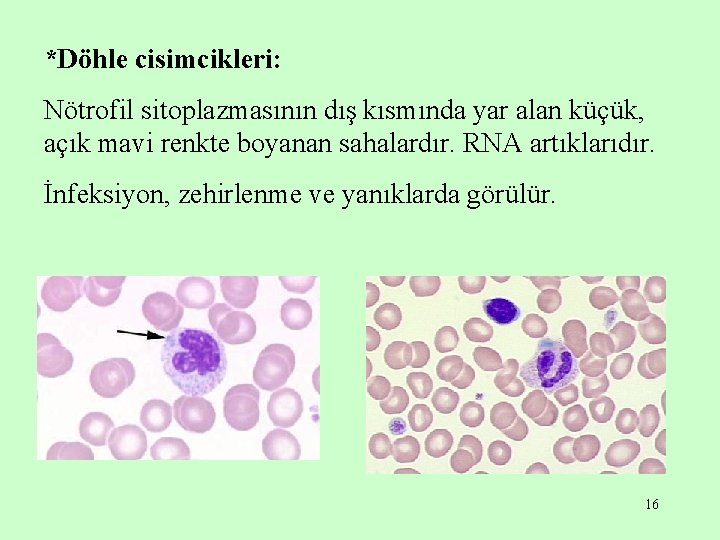 *Döhle cisimcikleri: Nötrofil sitoplazmasının dış kısmında yar alan küçük, açık mavi renkte boyanan sahalardır.