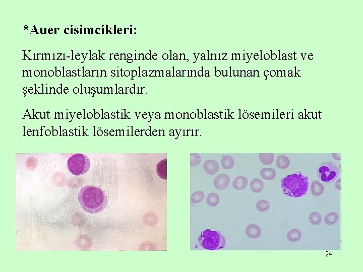 *Auer cisimcikleri: Kırmızı-leylak renginde olan, yalnız miyeloblast ve monoblastların sitoplazmalarında bulunan çomak şeklinde oluşumlardır.