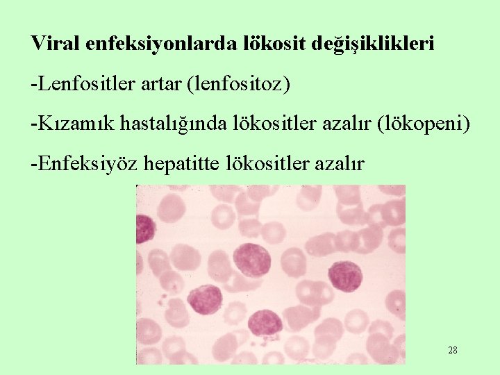Viral enfeksiyonlarda lökosit değişiklikleri -Lenfositler artar (lenfositoz) -Kızamık hastalığında lökositler azalır (lökopeni) -Enfeksiyöz hepatitte