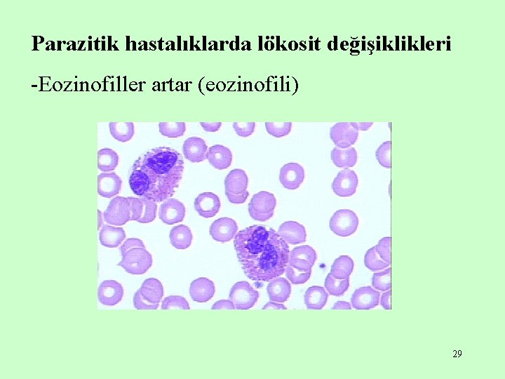 Parazitik hastalıklarda lökosit değişiklikleri -Eozinofiller artar (eozinofili) 29 