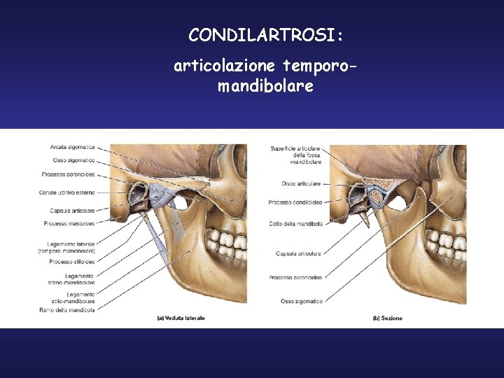 CONDILARTROSI: articolazione temporomandibolare 