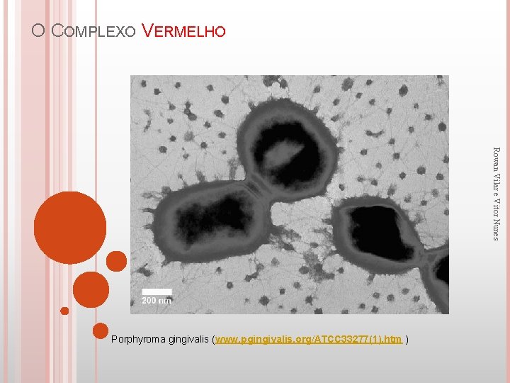 O COMPLEXO VERMELHO Rowan Vilar e Vitor Nunes Porphyroma gingivalis (www. pgingivalis. org/ATCC 33277(1).