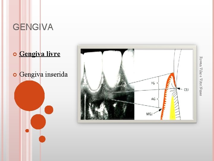 GENGIVA Gengiva livre Gengiva inserida Rowan Vilar e Vitor Nunes 