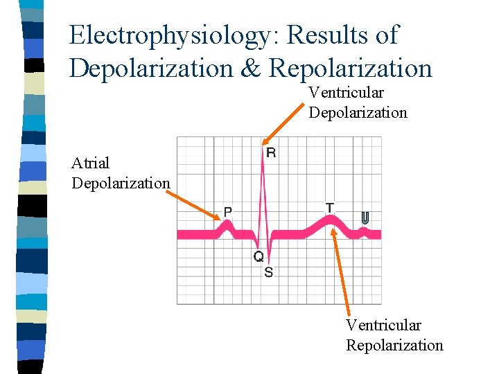 Electrophysiology: Results of Depolarization & Repolarization Ventricular Depolarization Atrial Depolarization Ventricular Repolarization 