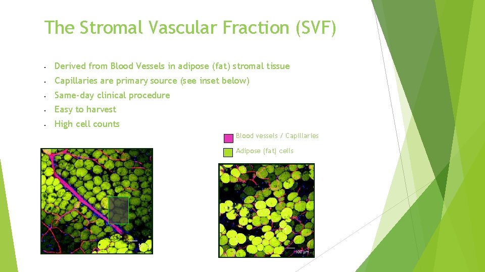 The Stromal Vascular Fraction (SVF) Derived from Blood Vessels in adipose (fat) stromal tissue