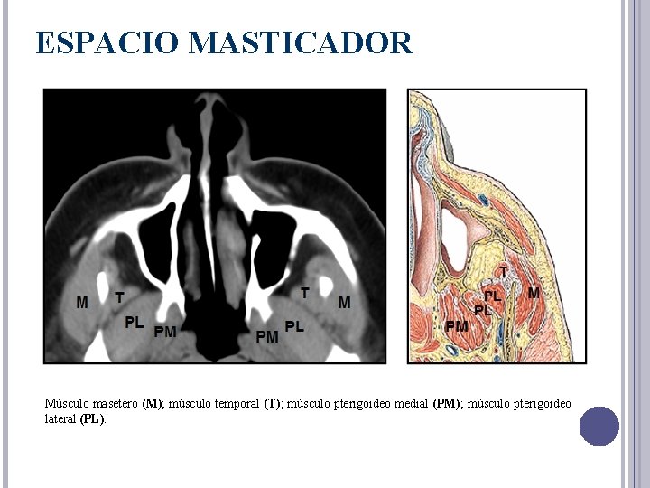 ESPACIO MASTICADOR Músculo masetero (M); músculo temporal (T); músculo pterigoideo medial (PM); músculo pterigoideo
