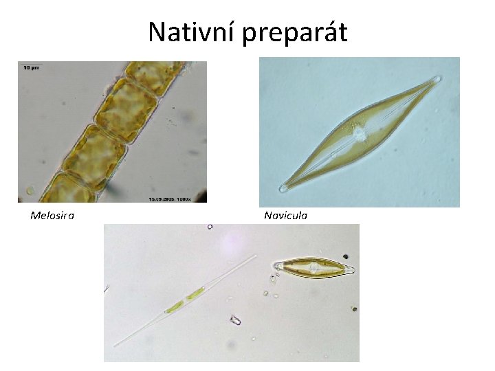 Nativní preparát Melosira Navicula 