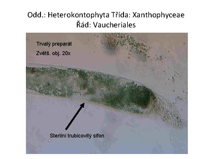 Odd. : Heterokontophyta Třída: Xanthophyceae Řád: Vaucheriales Trvalý preparát Zvětš. obj. 20 x Sterilní Odd. : Heterokontophyta Třída: Xanthophyceae Řád: Vaucheriales Trvalý preparát Zvětš. obj. 20 x Sterilní