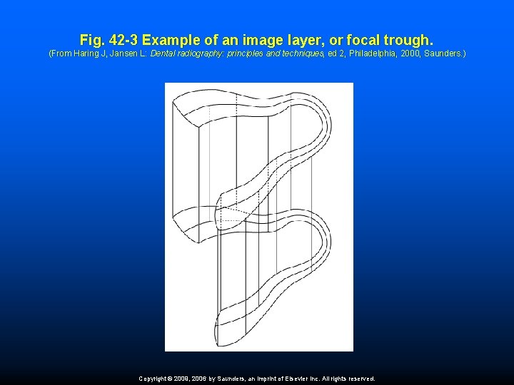 Fig. 42 -3 Example of an image layer, or focal trough. (From Haring J,