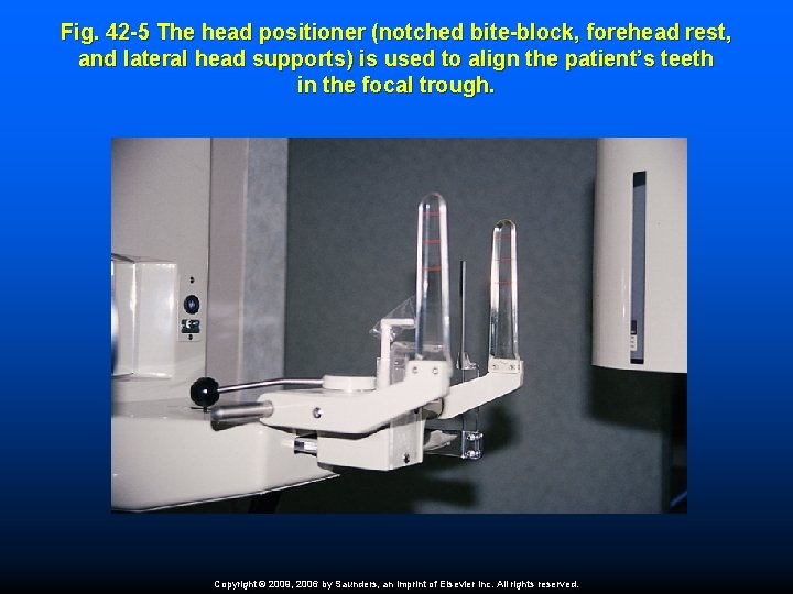Fig. 42 -5 The head positioner (notched bite-block, forehead rest, and lateral head supports)