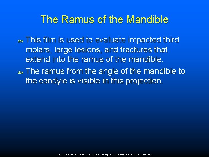 The Ramus of the Mandible This film is used to evaluate impacted third molars,