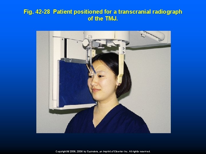 Fig. 42 -28 Patient positioned for a transcranial radiograph of the TMJ. Copyright ©
