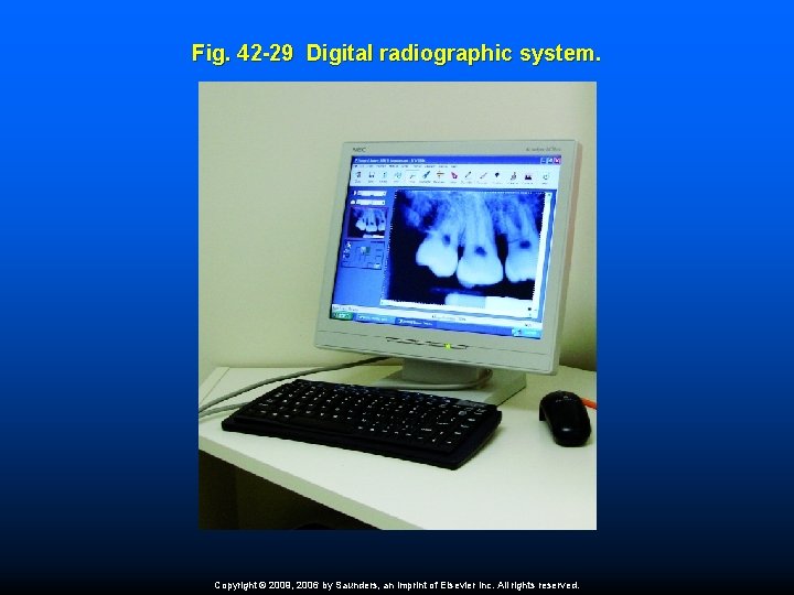 Fig. 42 -29 Digital radiographic system. Copyright © 2009, 2006 by Saunders, an imprint