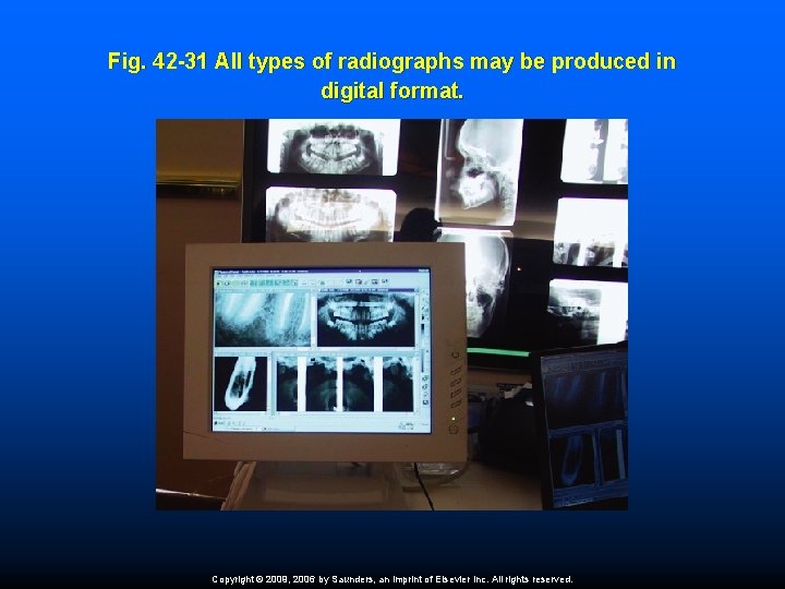 Fig. 42 -31 All types of radiographs may be produced in digital format. Copyright