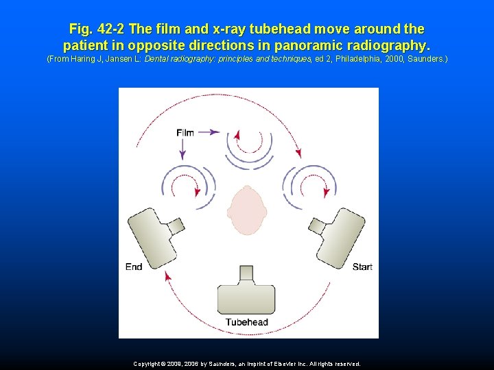 Fig. 42 -2 The film and x-ray tubehead move around the patient in opposite