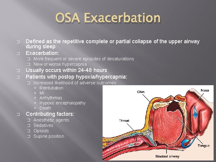 OSA Exacerbation � � Defined as the repetitive complete or partial collapse of the