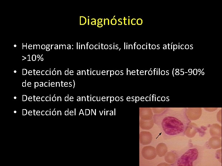 Diagnóstico • Hemograma: linfocitosis, linfocitos atípicos >10% • Detección de anticuerpos heterófilos (85 -90%