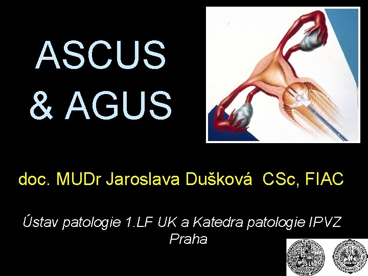 ASCUS & AGUS doc. MUDr Jaroslava Dušková CSc, FIAC Ústav patologie 1. LF UK