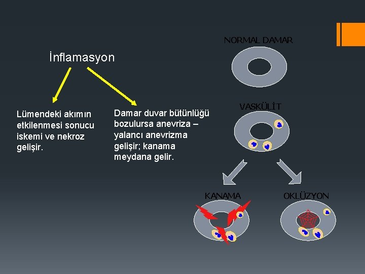 NORMAL DAMAR İnflamasyon Lümendeki akımın etkilenmesi sonucu iskemi ve nekroz gelişir. Damar duvar bütünlüğü