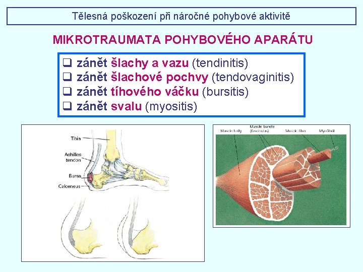 Tělesná poškození při náročné pohybové aktivitě MIKROTRAUMATA POHYBOVÉHO APARÁTU q zánět šlachy a vazu