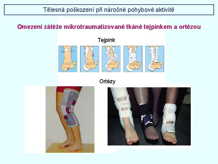 Tělesná poškození při náročné pohybové aktivitě Omezení zátěže mikrotraumatizované tkáně tejpinkem a ortézou Tejpink Tělesná poškození při náročné pohybové aktivitě Omezení zátěže mikrotraumatizované tkáně tejpinkem a ortézou Tejpink