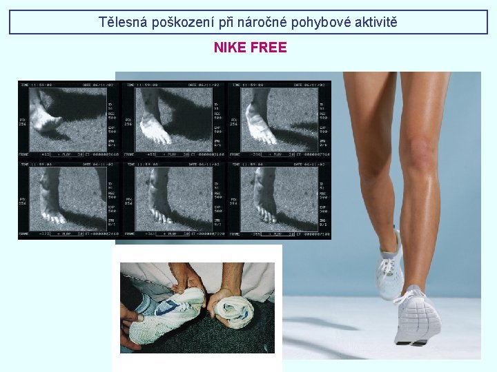 Tělesná poškození při náročné pohybové aktivitě NIKE FREE 