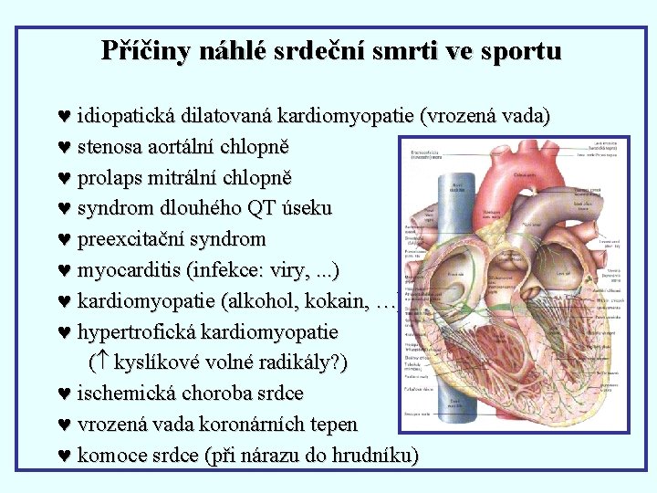 Příčiny náhlé srdeční smrti ve sportu © idiopatická dilatovaná kardiomyopatie (vrozená vada) © stenosa