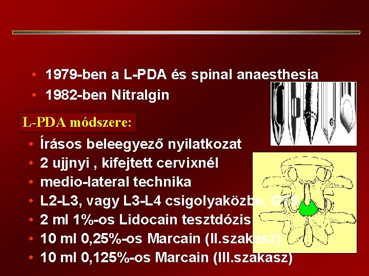  • 1979 -ben a L-PDA és spinal anaesthesia • 1982 -ben Nitralgin L-PDA