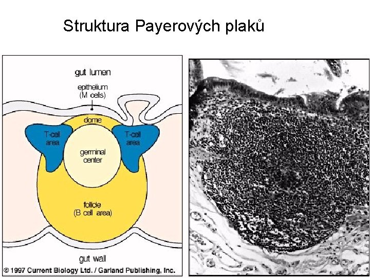 Struktura Payerových plaků 