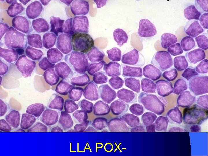 LLA POX- 