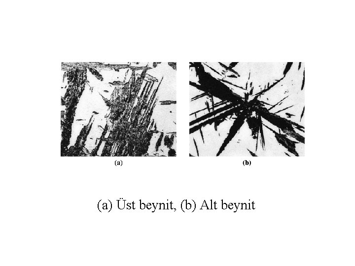 (a) Üst beynit, (b) Alt beynit 