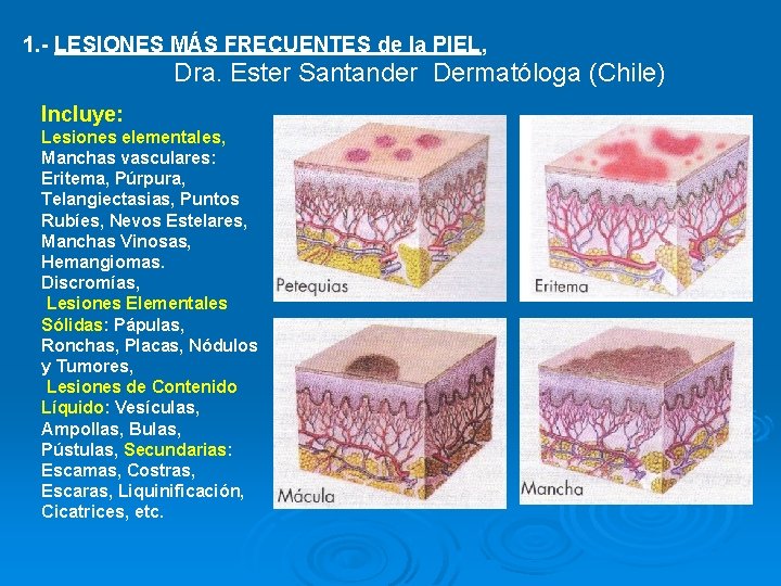 1. - LESIONES MÁS FRECUENTES de la PIEL, Dra. Ester Santander Dermatóloga (Chile) Incluye:
