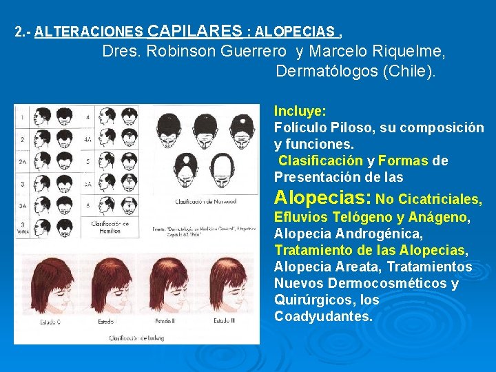 2. - ALTERACIONES CAPILARES : ALOPECIAS , Dres. Robinson Guerrero y Marcelo Riquelme, Dermatólogos