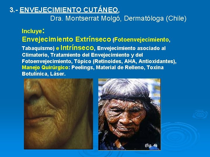 3. - ENVEJECIMIENTO CUTÁNEO, Dra. Montserrat Molgó, Dermatóloga (Chile) Incluye: Envejecimiento Extrínseco (Fotoenvejecimiento, Tabaquismo)