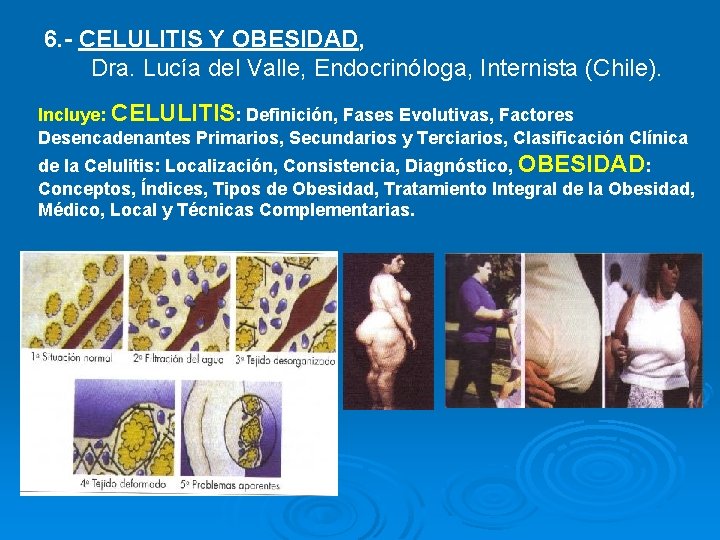 6. - CELULITIS Y OBESIDAD, Dra. Lucía del Valle, Endocrinóloga, Internista (Chile). Incluye: CELULITIS: