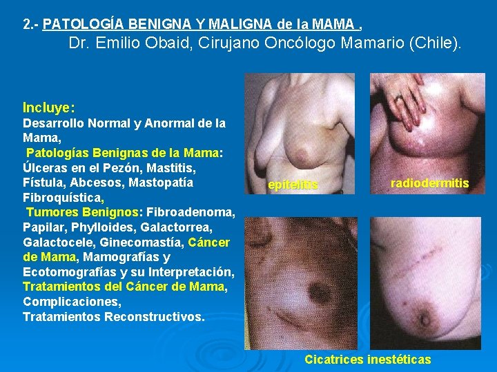 2. - PATOLOGÍA BENIGNA Y MALIGNA de la MAMA , Dr. Emilio Obaid, Cirujano