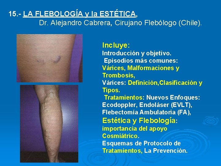 15. - LA FLEBOLOGÍA y la ESTÉTICA, Dr. Alejandro Cabrera, Cirujano Flebólogo (Chile). Incluye: