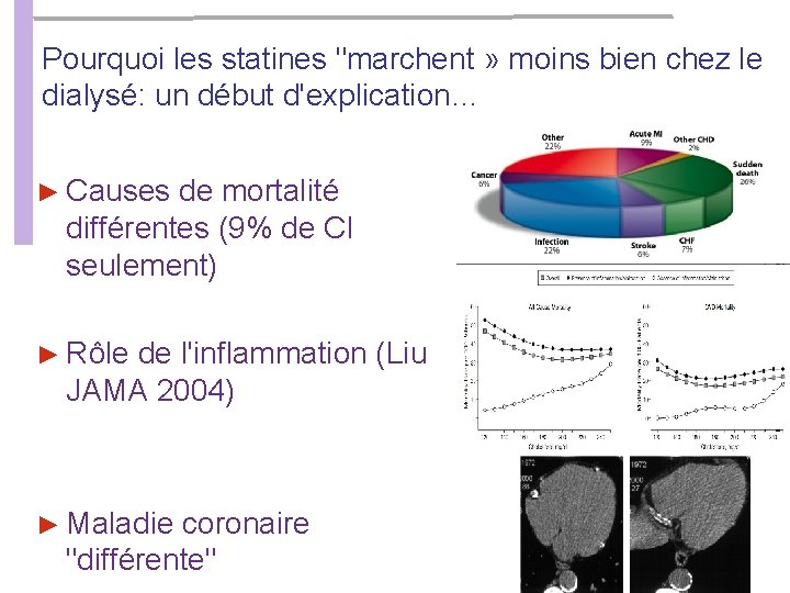 Pourquoi les statines "marchent » moins bien chez le dialysé: un début d'explication… ► Pourquoi les statines "marchent » moins bien chez le dialysé: un début d'explication… ►