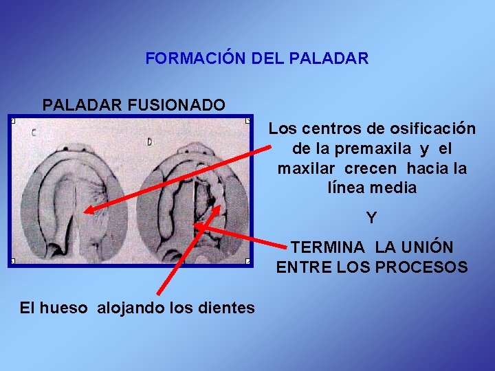 FORMACIÓN DEL PALADAR FUSIONADO Los centros de osificación de la premaxila y el maxilar