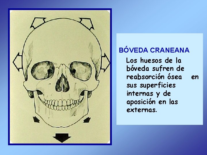 BÓVEDA CRANEANA Los huesos de la bóveda sufren de reabsorción ósea en sus superficies