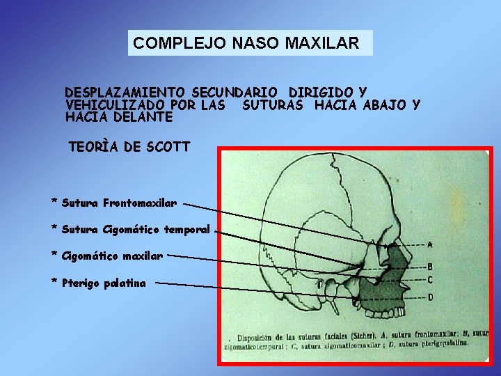 COMPLEJO NASO MAXILAR DESPLAZAMIENTO SECUNDARIO DIRIGIDO Y VEHICULIZADO POR LAS SUTURAS HACIA ABAJO Y