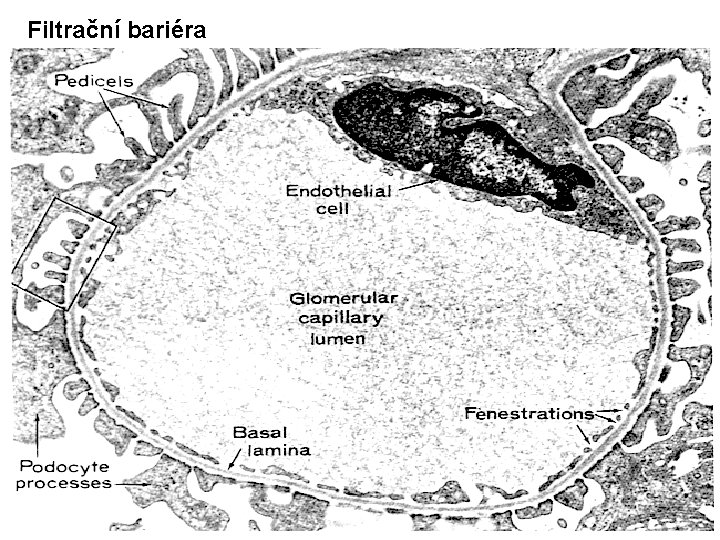 Filtrační bariéra 