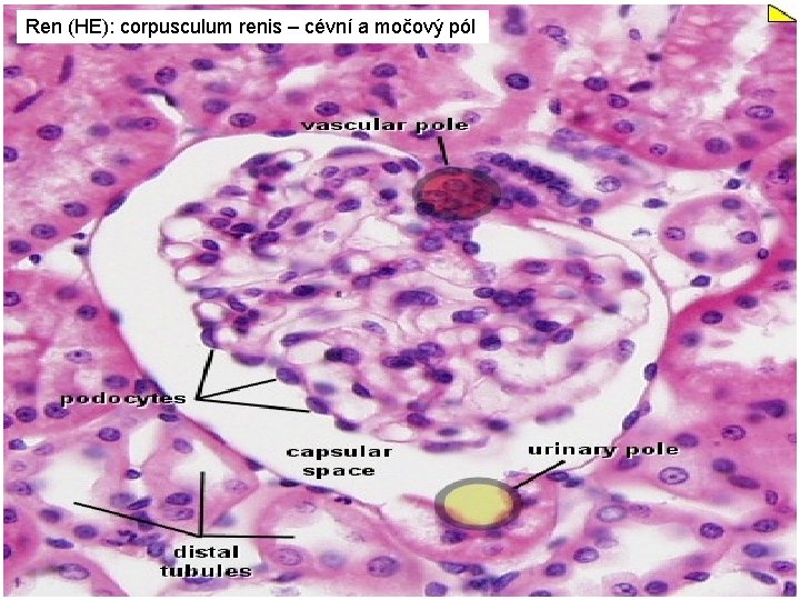 Ren (HE): corpusculum renis – cévní a močový pól 