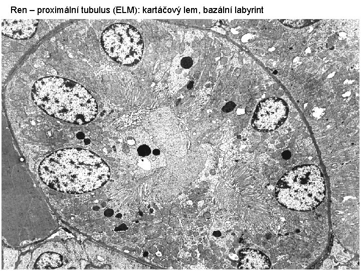 Ren – proximální tubulus (ELM): kartáčový lem, bazální labyrint 