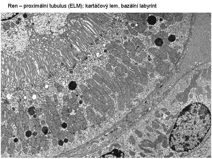 Ren – proximální tubulus (ELM): kartáčový lem, bazální labyrint 