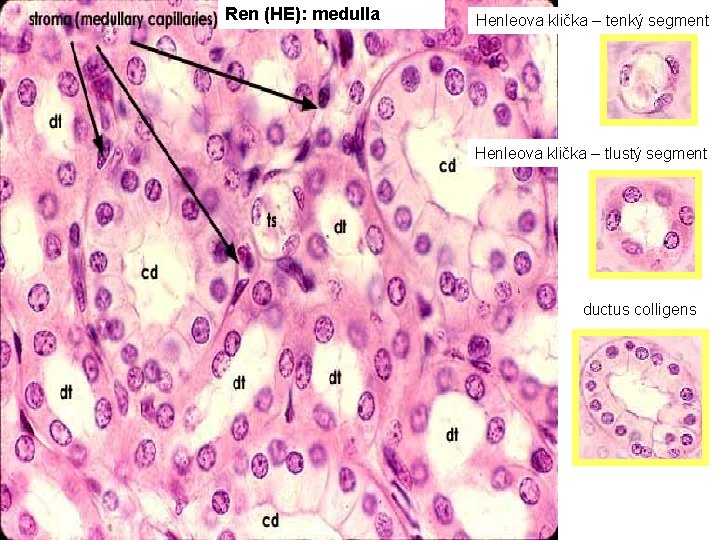 Ren (HE): medulla Henleova klička – tenký segment Henleova klička – tlustý segment ductus