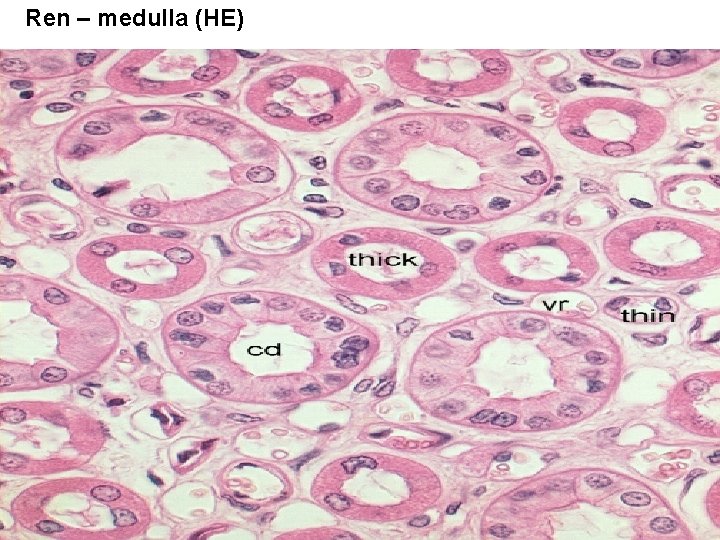 Ren – medulla (HE) 