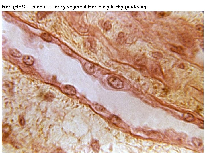 Ren (HES) – medulla: tenký segment Henleovy kličky (podélně) 