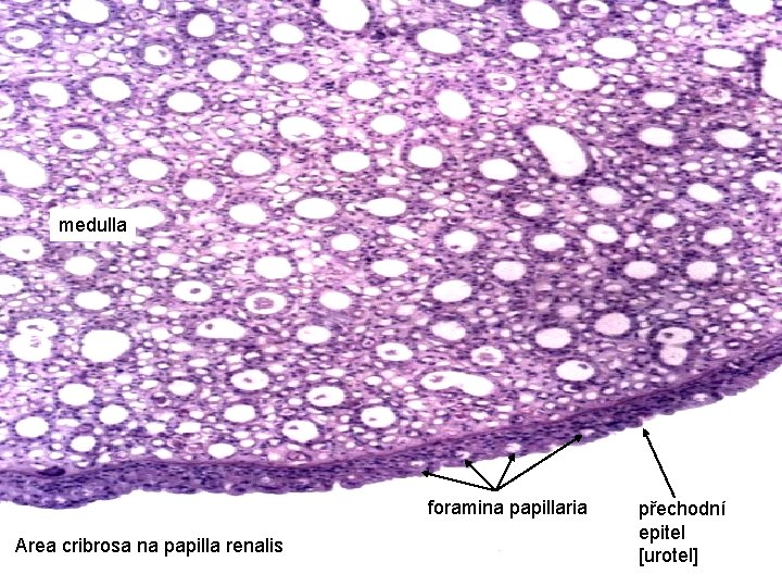 medulla foramina papillaria Area cribrosa na papilla renalis přechodní epitel [urotel] 
